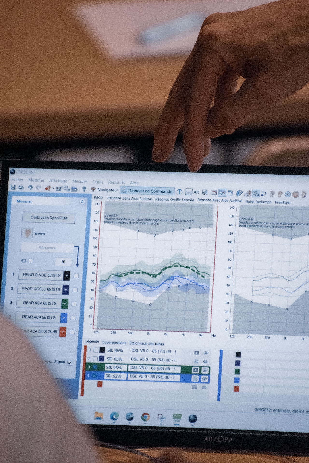 Analyse de courbes de mesure in vivo sur OTOsuite